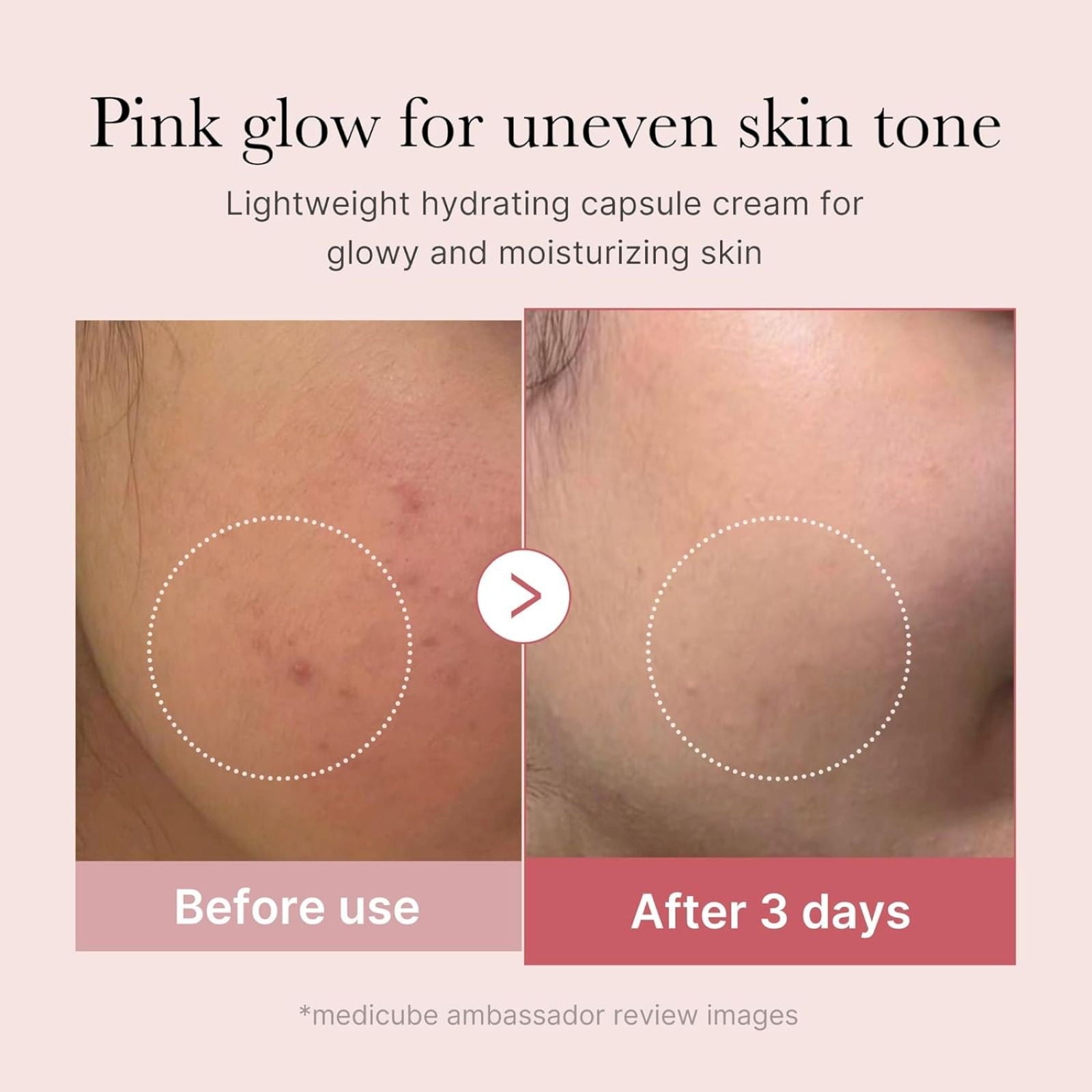 - Korean Skincare, Lightweight Gel Cream, Improves Skin Tone, Hydrating Glow Formula, Anti-Aging PDRN Complex, for Sensitiv Makeup Organizers